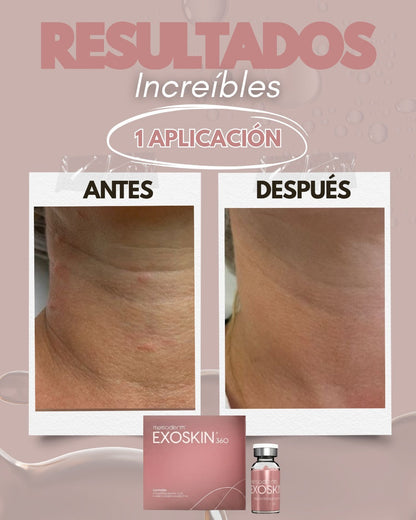 EXOSKIN 360 1 Caja