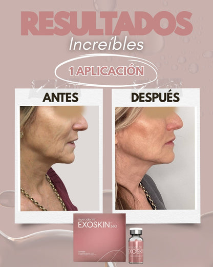 EXOSKIN 360 1 Caja