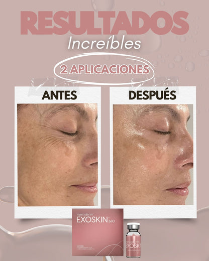 EXOSKIN 360 2 Cajas