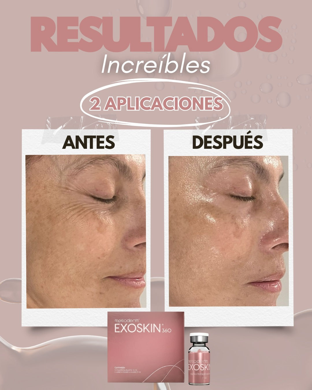 EXOSKIN 360 1 Caja