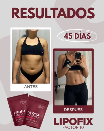 Lipofix Factor 10