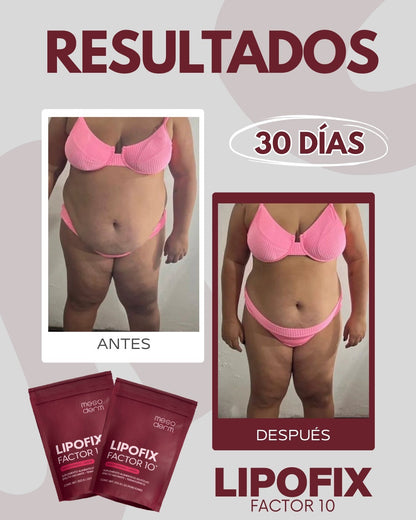 Lipofix Factor 10