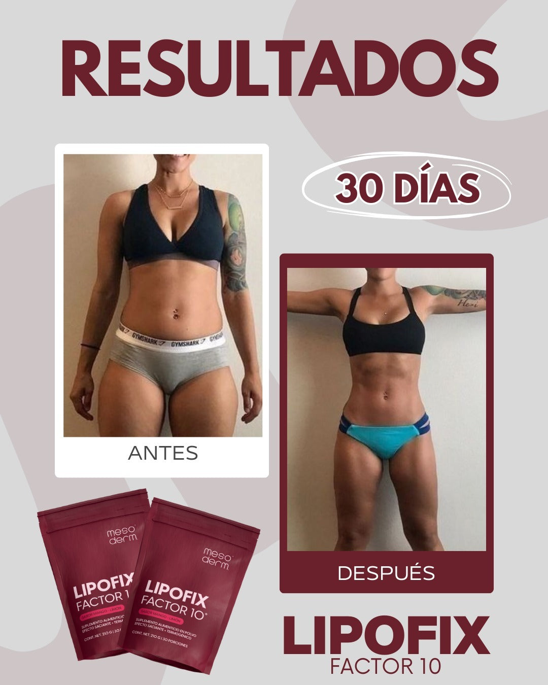 Lipofix Factor 10