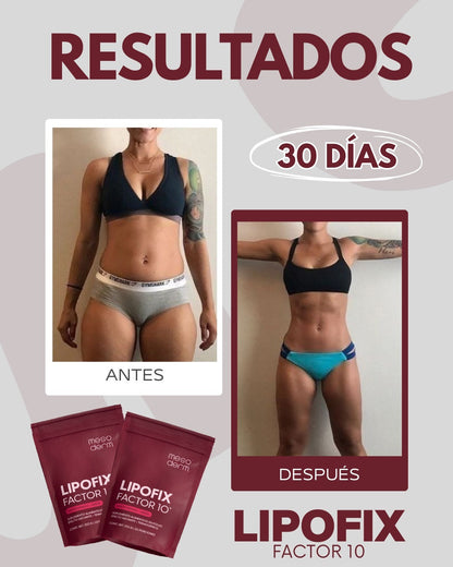 Lipofix Factor 10