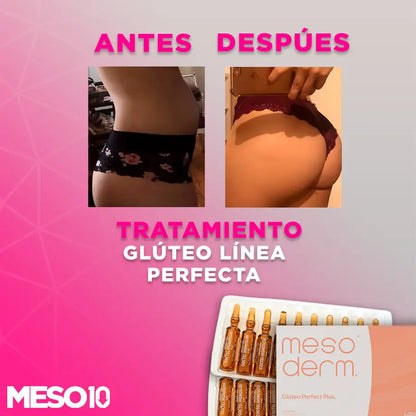 Tratamiento Glúteo Perfect Line