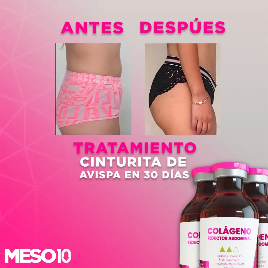 Tratamiento “Cinturita de Avispa en 30 Días”