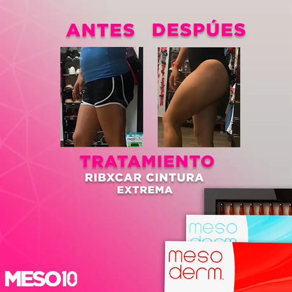 Tratamiento Ribxcar Cintura Extrema