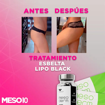 Tratamiento Esbelta Lipo Black